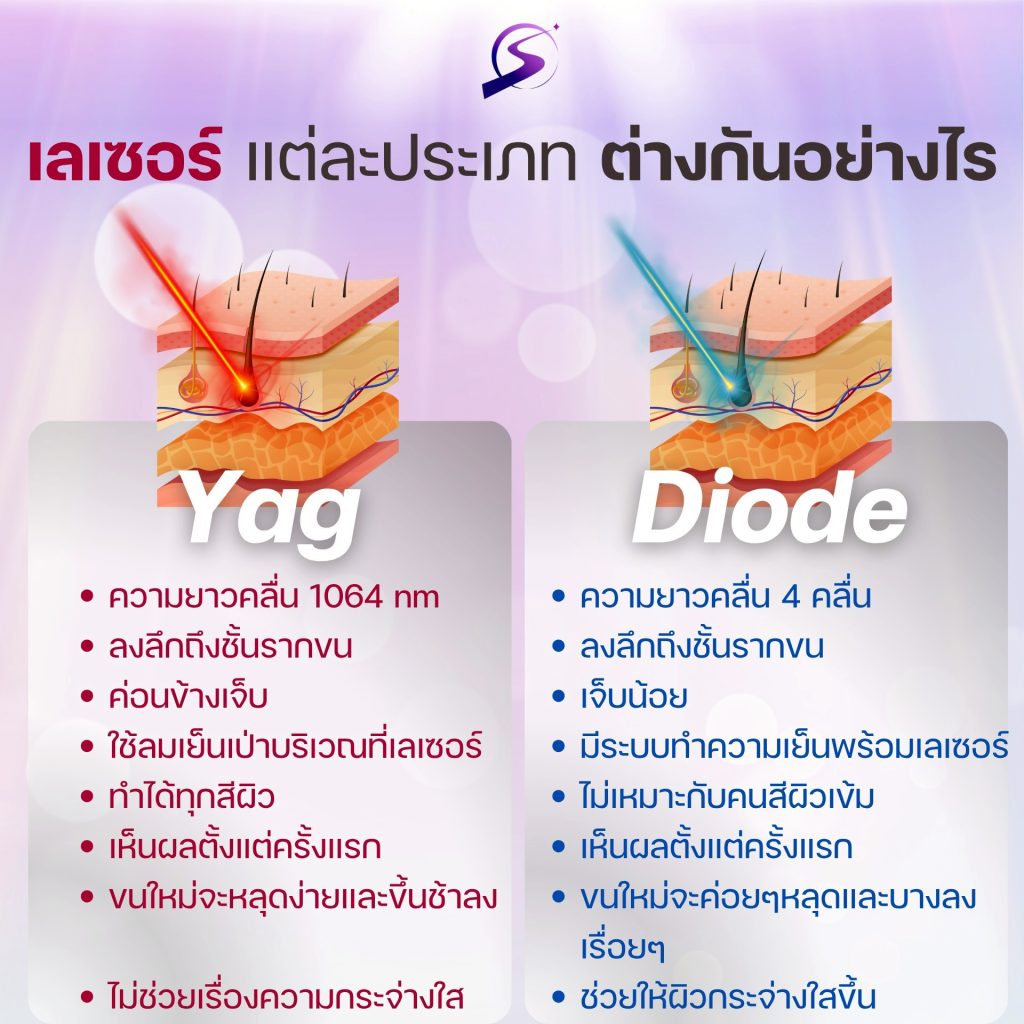 เลเซอร์แต่ละประเภทแตกต่างกันอย่างไร Yag-Diode