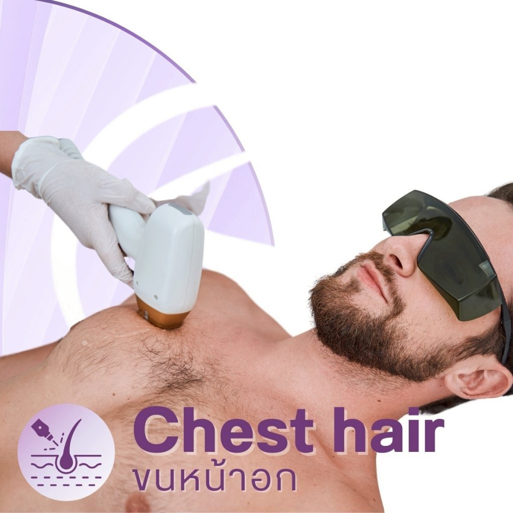 โปรแกรมบริเวณ Laser ของทางคลินิก-Chest hair